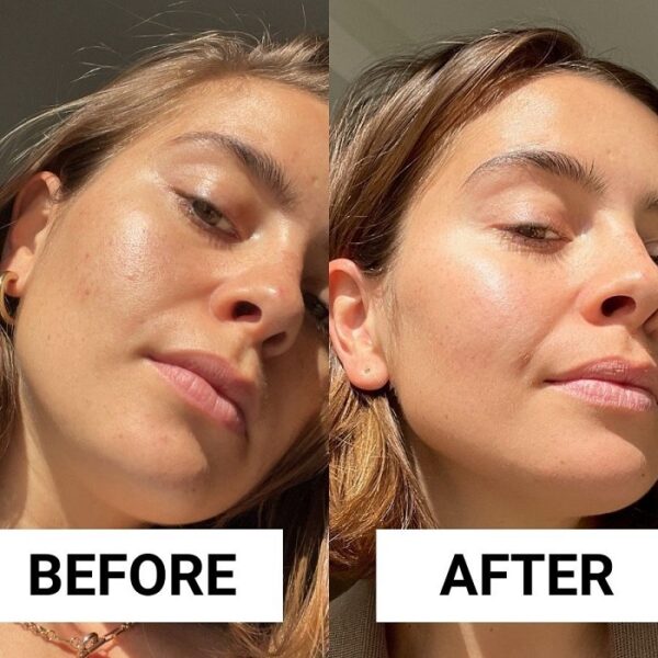 Retinol Before and After: The Ultimate Guide to Transforming Your Skin