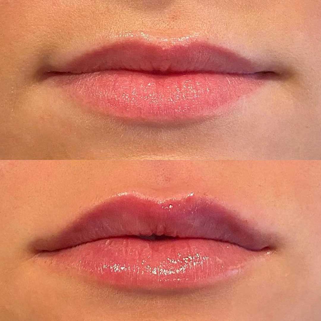 Lip Blushing: Everything You Need to Know