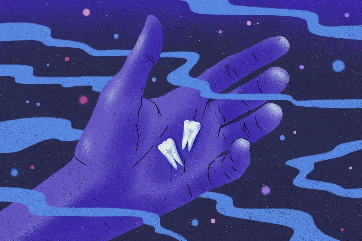 12 Surprising Interpretations When Your Teeth Are Falling Out in Dreams