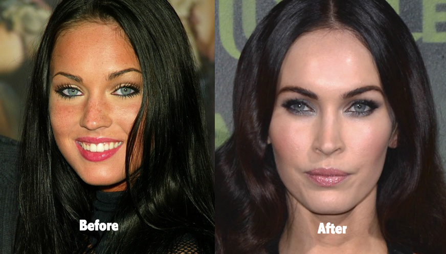 Megan Fox Before & After: Transformation, Plastic Surgery Disclosures & Style Evolution